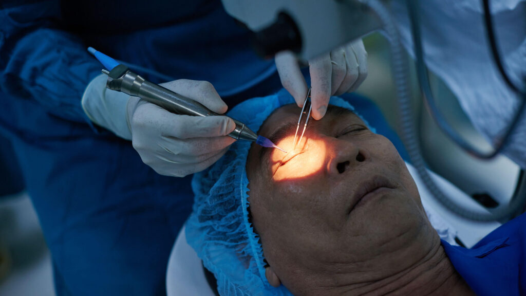 Glaucoma Surgery and Recovery